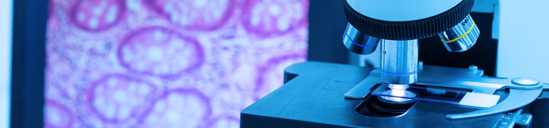 A screen on the left shows purple circles. that are being magnified from a microscope on the right.